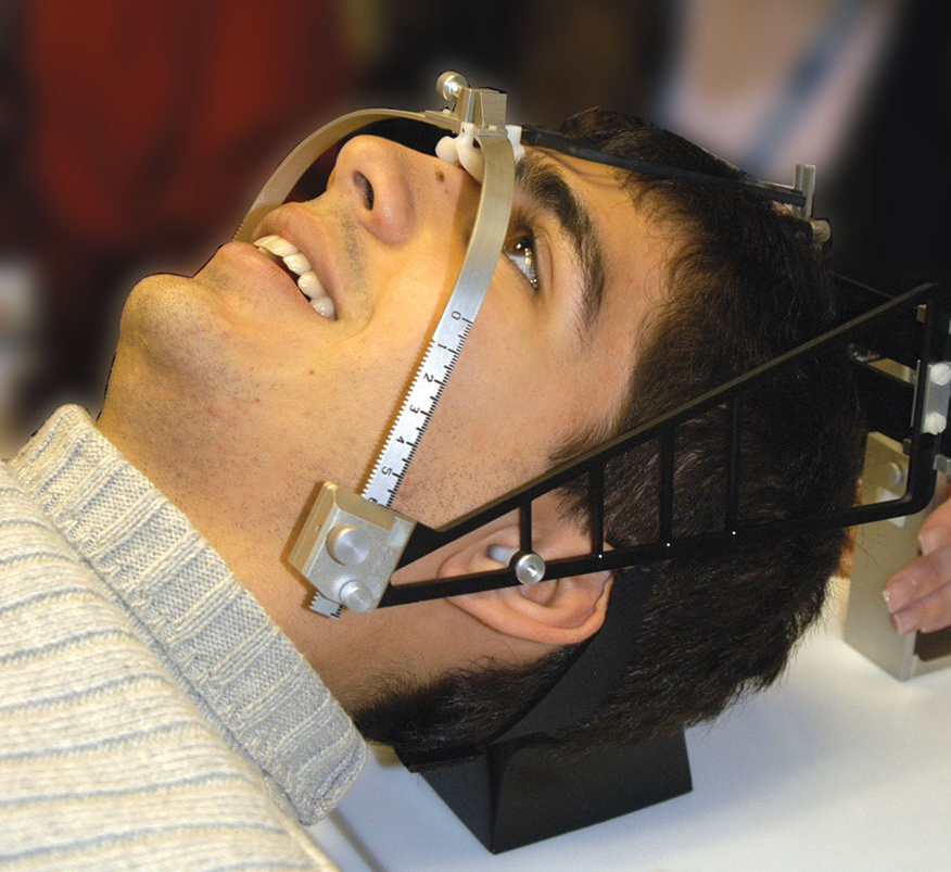 Brain Radiosurgery Frame