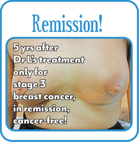 Breast Cancer Before & After