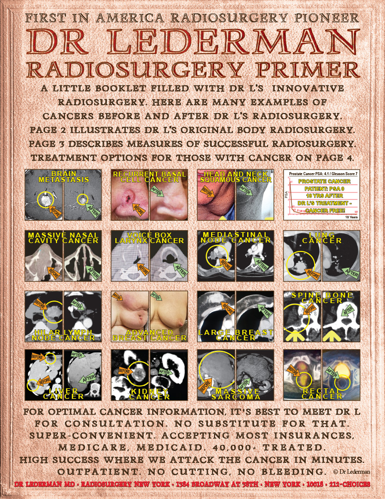 Dr Lederman Radiosurgery Primer