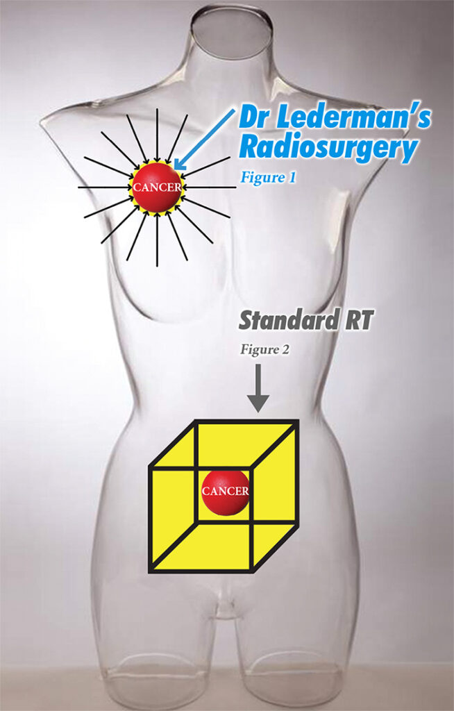 Radiosurgery verse Standard Radiation