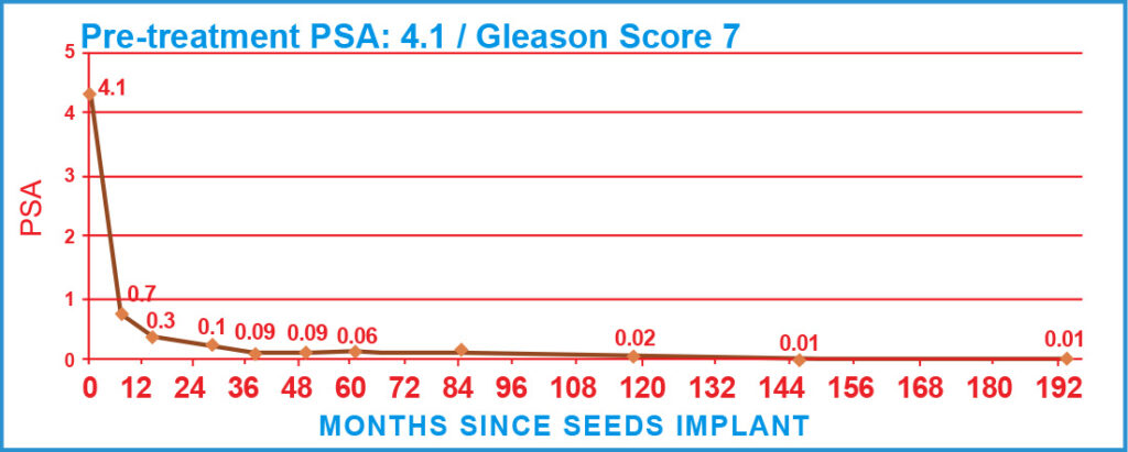 PSA Charts of Prostate Cancer