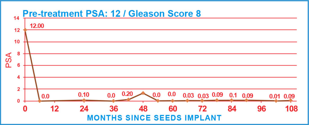 PSA Charts of Prostate Cancer