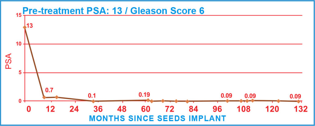 PSA Charts of Prostate Cancer