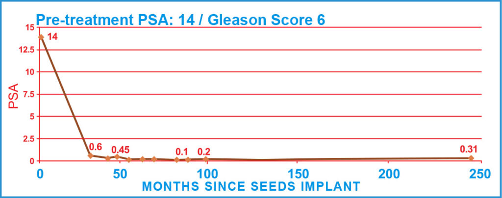 PSA Charts of Prostate Cancer