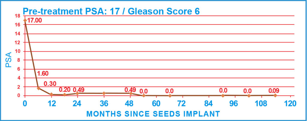 PSA Charts of Prostate Cancer