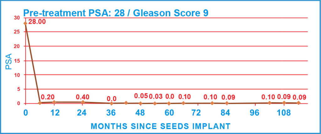 PSA Charts of Prostate Cancer