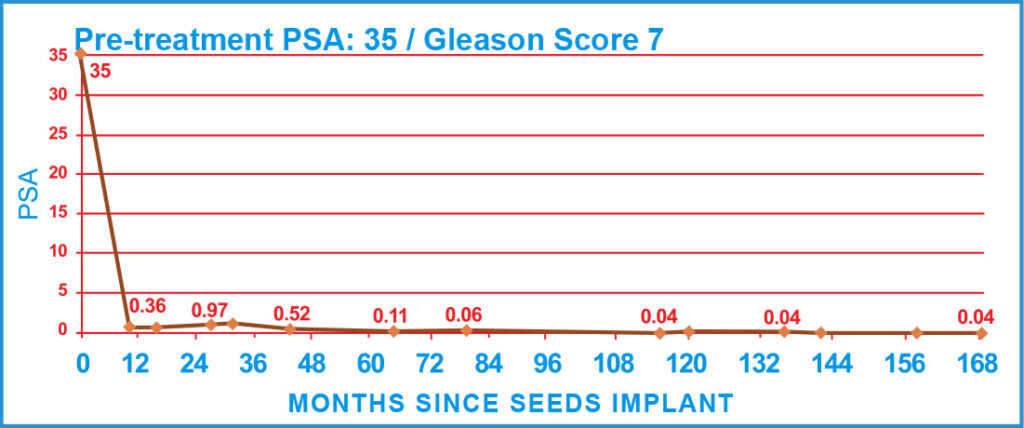 PSA Charts of Prostate Cancer