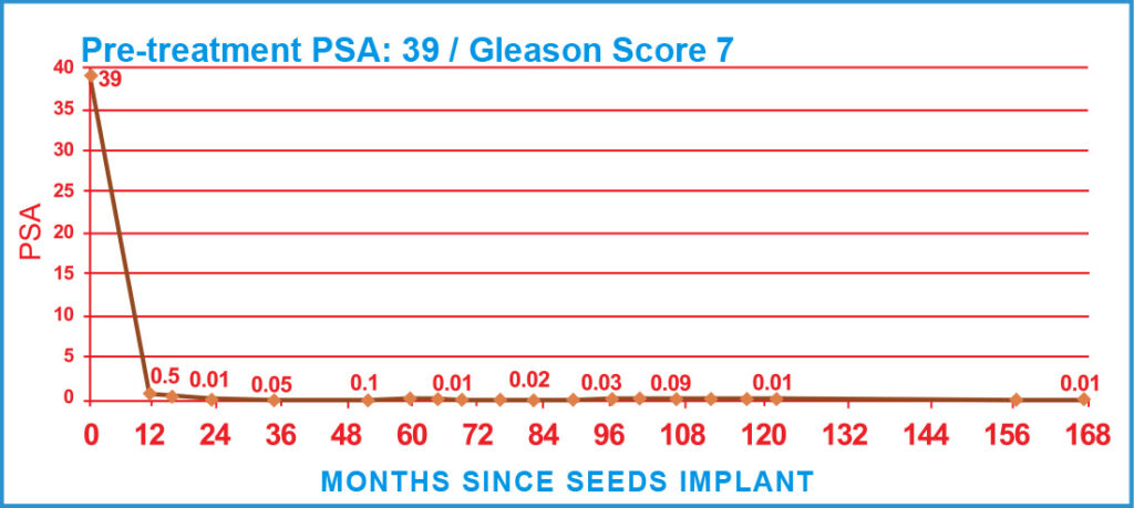 PSA Charts of Prostate Cancer