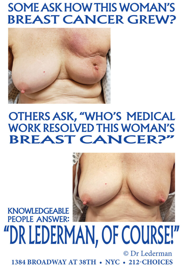 How This Breast Cancer Grew